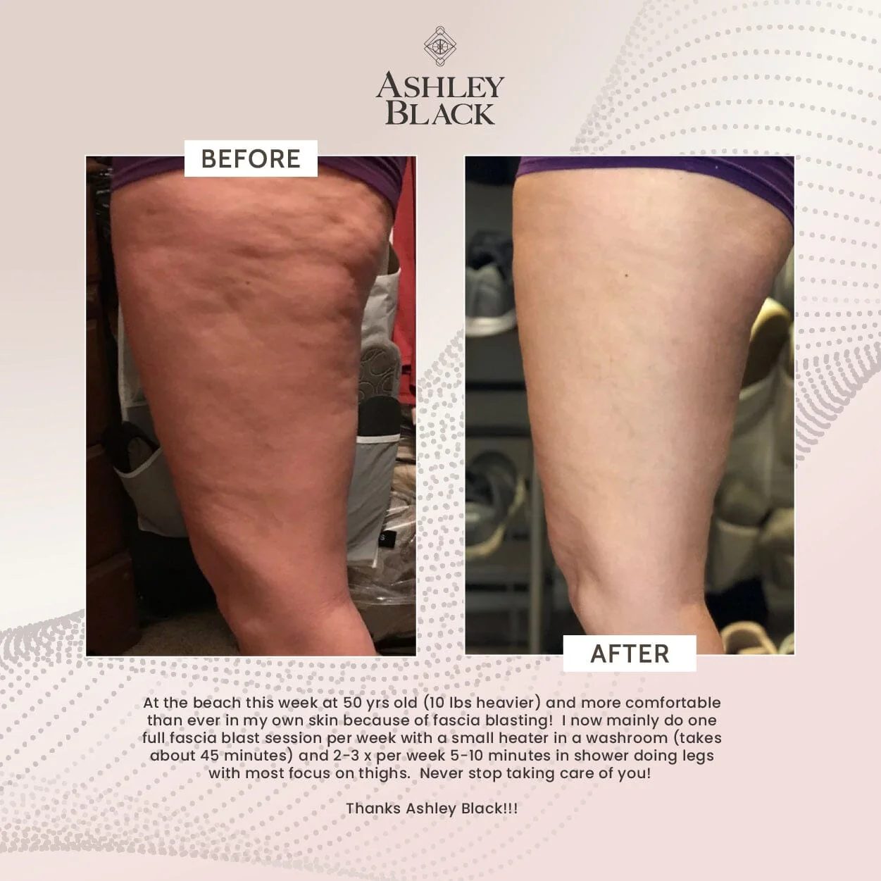 FasciaBlaster by Ashley Black – Original Tool - Image 4